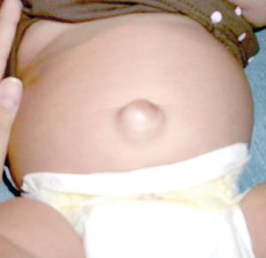 Why touching your belly button makes you need the toilet